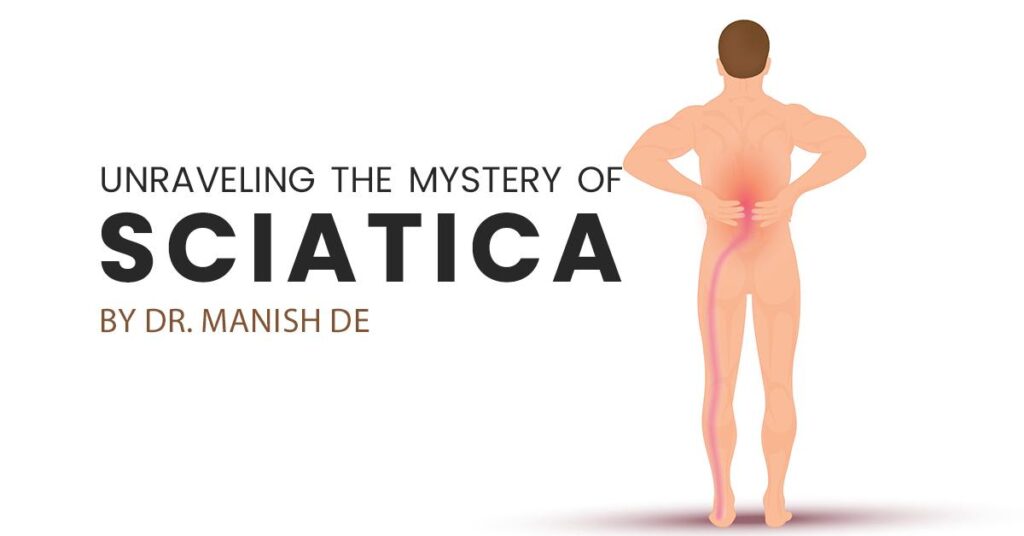 Unraveling the Mystery of SCIATICA